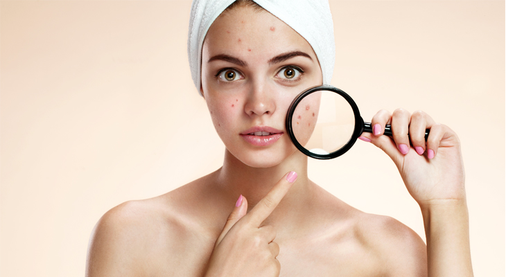 acne mask