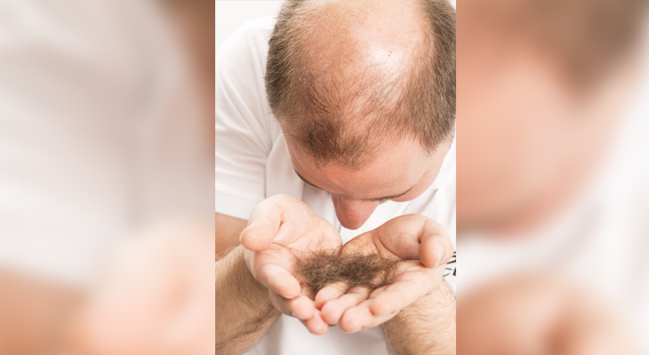 best shampoo for hair growth