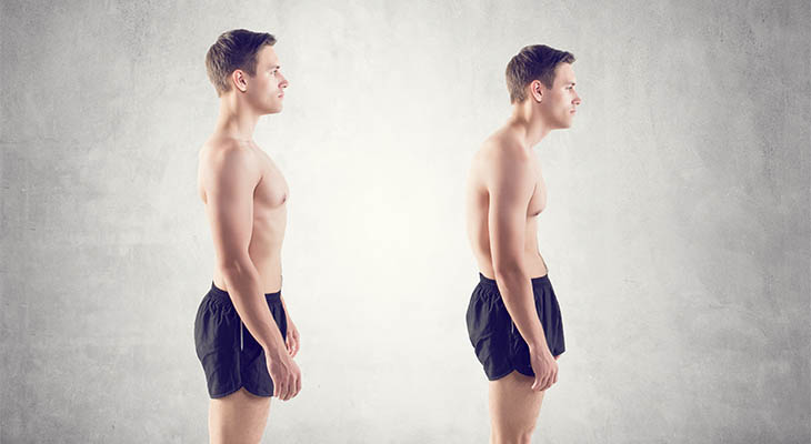 posture corrector for men