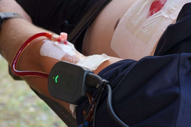 a blood warming device on patient's arm during transfusion
